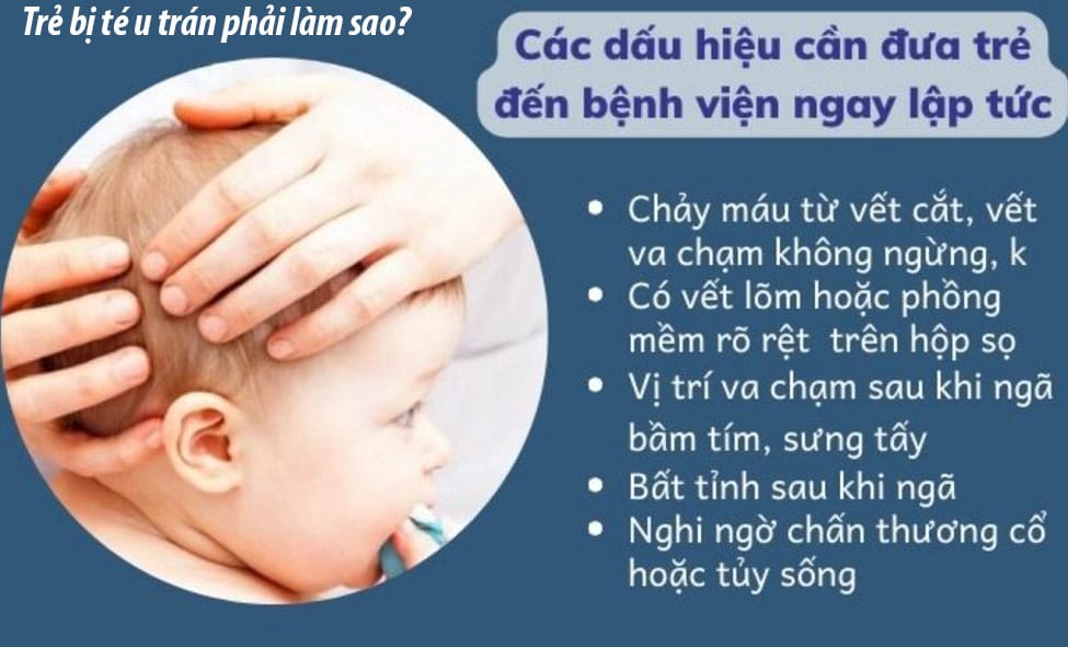 Trẻ bị té u trán phải làm sao, cách xử lí khi bé bị ngã u trán
